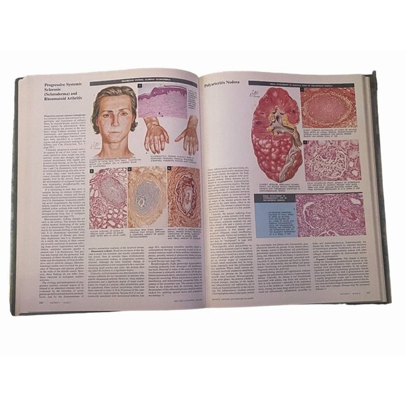 Netter's CIBA Medical Illustrations: Kidneys, Ureters, Bladder, Vol 6 - Picture 6 of 7